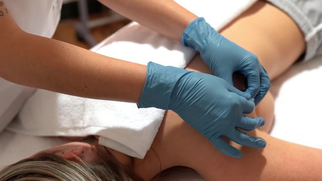 Hands of physiotherapist doing a dry needling
