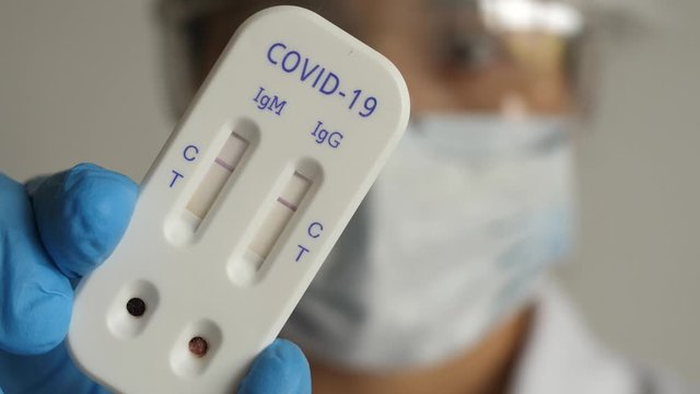 antibody immunological serological quick covid covid-19 test negative showing