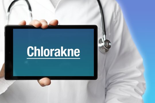 Chlorakne. Arzt mit Stethoskop hält Tablet-Computer in Hand. Text im Display. Blauer Hintergrund. Krankheit, Gesundheit, Medizin
