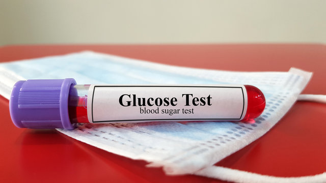 Laboratory sample tube of blood glucose level test.High fasting blood sugar(FBS)level or Fasting plasma glucose(FPG)for diagnosis hyperglycemia in Diabetes mellitus disease(DM).Medical testing concept