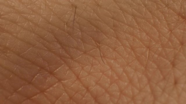 Human skin texture, close-up. Dry skin care concept. Moisturizing and nourishing the skin, background, epidermis