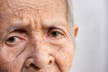 The old woman's felling lonely.(dementia and Alzheimer’s disease)