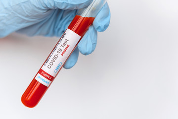 Naklejka premium Coronavirus covid 19 infected blood sample in tube in hand of scientist on white background. New virus covid-19 vaccine research.