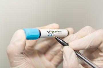 Test tube with a blood sample for a test for antibodies to coronavirus in the hands of a laboratory assistant in gloves, writes a negative sign a pen, isolated on white, closeup.