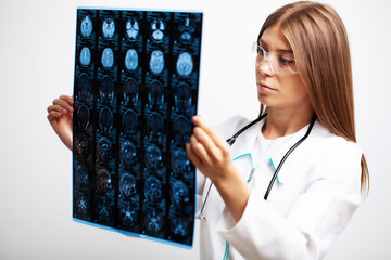 Doctor examines an MRI image of the patient's brain