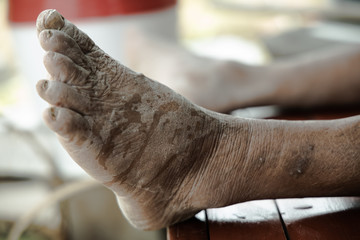 Dirty old man's feet on table.