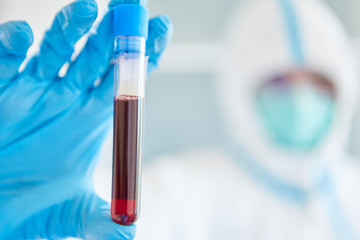 Scientist in the laboratory stops taking blood