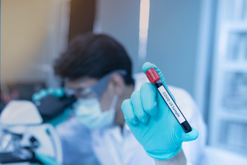 Close-up laboratory scientist hands in gloves holding test tube with blood sample for COVID-19 analyzing.