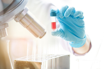 Coronavirus 2019-nCoV Blood Sample.  with microscope lab for vaccine