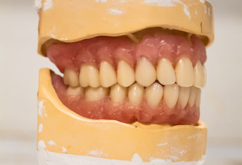 Dentadura postiza en articulador