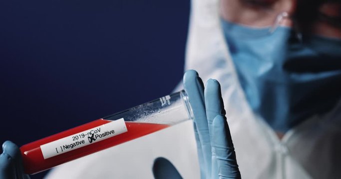 Close up of glass tube with blood and positive coronavirus result in hands in gloves of Caucasian equipped male laborant. Covid-19 laboratory testing.