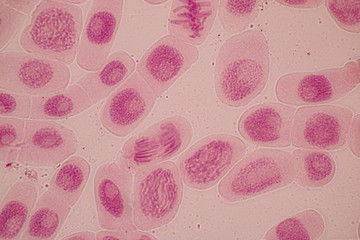 Root tip of Onion and Mitosis cell in the Root tip of Onion under a microscope.
