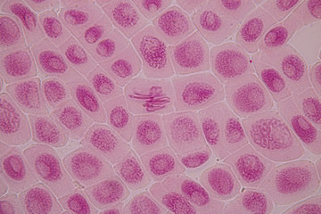 Root tip of Onion and Mitosis cell in the Root tip of Onion under a microscope.
