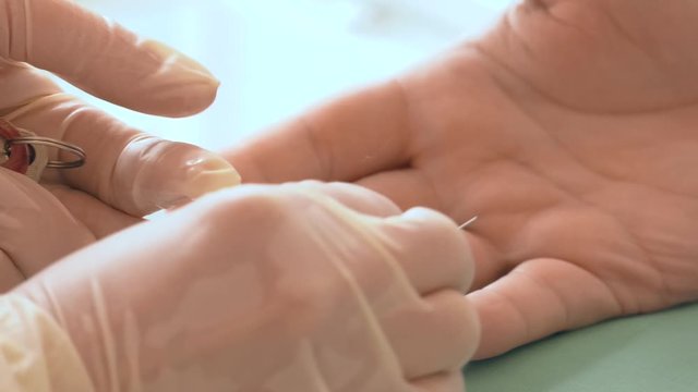 Doctor making a test kit for viral disease COVID-19 2019-nCoV. Laboratory card kit test for SARS-CoV-2 virus coronavirus. COVID-19 rapid test. Positive COVID-19. Blood sampling from a finger.
