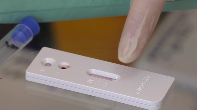 Lab card kit tested positive for viral novel coronavirus sars-cov-2 virus. Doctor show rapid laboratory COVID-19 test for diagnosis new Corona virus infection, ready for screening and treatment.
