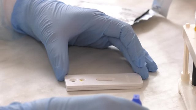 The reagent is added to the blood. Doctor making a test kit for viral disease COVID-19 2019-nCoV. Laboratory card kit test for SARS-CoV-2 virus coronavirus. COVID-19 rapid test. Positive COVID-19.

