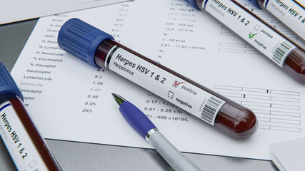 Herpes Virus Bluttest