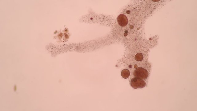 Amoebae move and feed by using pseudopods, which are bulges of cytoplasm formed by the coordinated action of actin microfilaments pushing out the plasma membrane that surrounds the cell.
