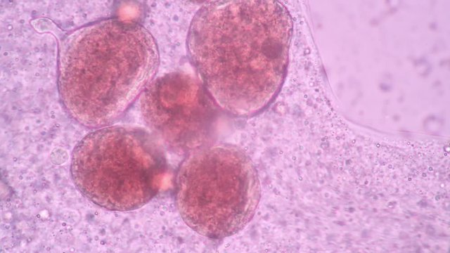 Amoebae move and feed by using pseudopods, which are bulges of cytoplasm formed by the coordinated action of actin microfilaments pushing out the plasma membrane that surrounds the cell.
