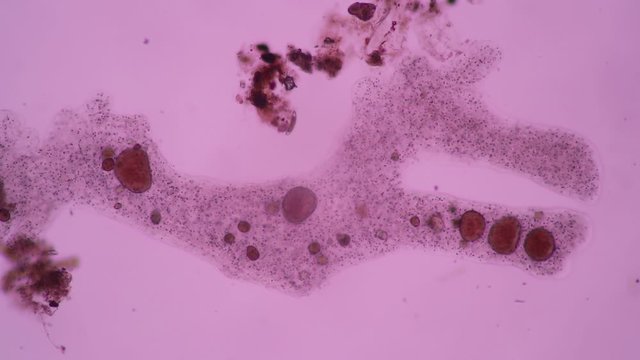 Amoebae move and feed by using pseudopods, which are bulges of cytoplasm formed by the coordinated action of actin microfilaments pushing out the plasma membrane that surrounds the cell.
