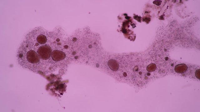 Amoebae move and feed by using pseudopods, which are bulges of cytoplasm formed by the coordinated action of actin microfilaments pushing out the plasma membrane that surrounds the cell.
