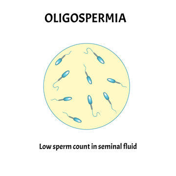 Teratospermia Images – Browse 138 Stock Photos, Vectors, and Video ...