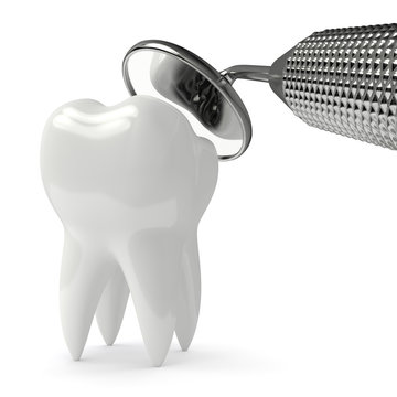 3d render of tooth decay and dental mirror over white