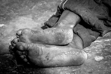 dirty soles of feet of indian man