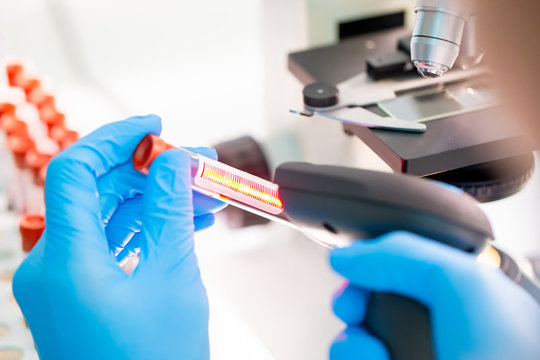 blood test result concept