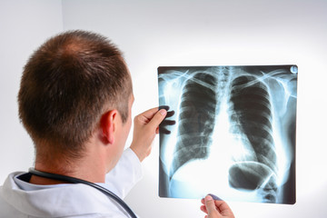 Doctor with radiological chest x-ray film for medical diagnosis on patient's health on asthma, lung disease and bone cancer illness