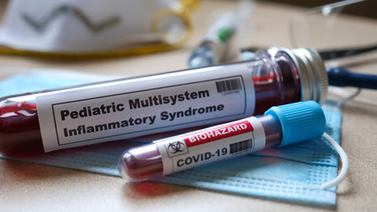 Pediatric multisystem inflammatory syndrome. kawasaki disease symptoms.