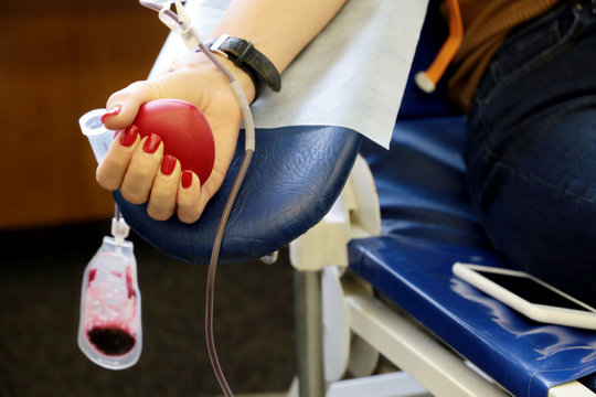 Woman blood donor in chair during donation with a blood bag and red bouncy ball in hand. Concept of donorship, transfusion, health care