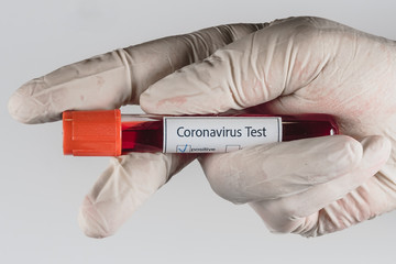 Vacuum tube with a blood sample with a positive result for Covid-19 infection in the hand with a medical glove on a white background