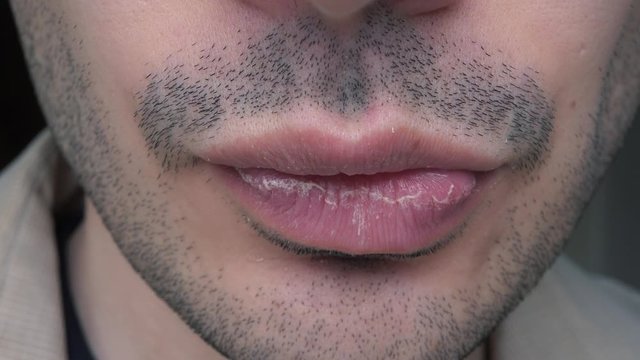 Closeup shot of a man with a scruffy face and  dry , cracked lips .