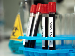 Blood sample in test tube for COVID-19 testing. Novel coronavirus 2019 found in Wuhan, China....