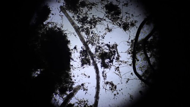 Naididae movement at 40x magnification