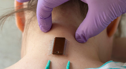 implantation of chip under the human skin. microchip is connected to the female body.