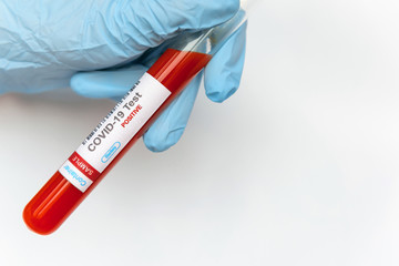 Fototapeta premium Coronavirus covid 19 infected blood sample in tube in hand of scientist on white background. New virus covid-19 vaccine research.
