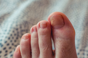 young man feet