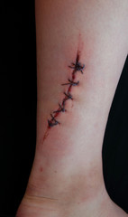 Leg wound, surgical suture, skin wound sewn with thread, close-up on a black background