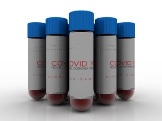 3D illustration covid 19 blood testing with sample bottle