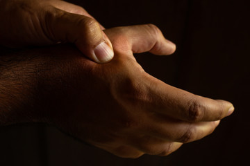 Adult male hands with abundant hair pressing the metacarpus.