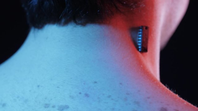 Chip on the neck of a man