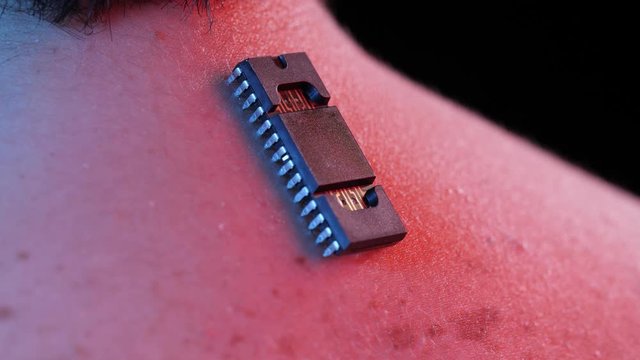 Implanted chip on the neck of a man