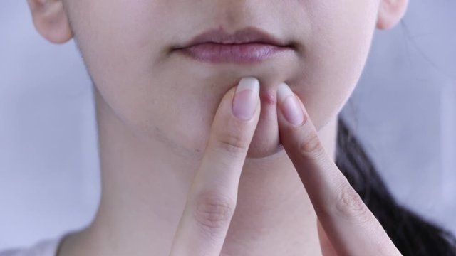 Skin care. A young woman squeezes out a pimple on her face. Skin treatment, beauty. Close up. Acne, redness, blemishes,spots, blackheads, cosmetology. Teen, hormones, oily skin. Panic, trouble