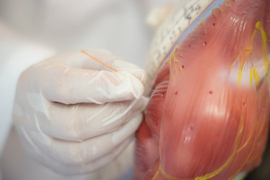 Chinese acupuncture model. Have clear position points (Chinese Language). For education studying alternative medicine or doctor pointed out where to pierce the needle for the patient or the junior