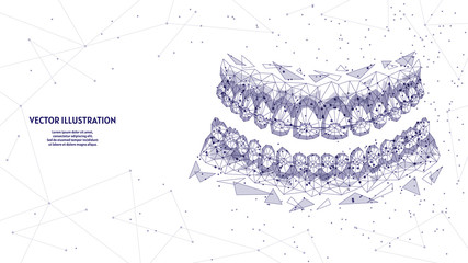Dental jaw with braces on teeth close-up. Correct bite correction of teeth. Orthodontics, stomotology, innovative medical technology. 3d low poly wireframe vector illustration.