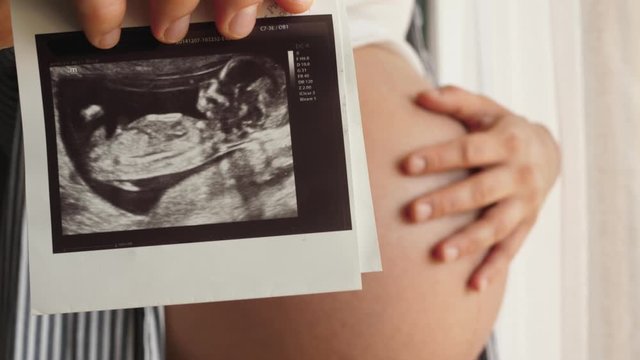 pregnant woman strokes her belly shows ultrasound picture to camera