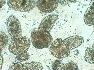 Protoscolices Echinococcus multilocularis microscopic photo of being released from a larvacyst. Is...