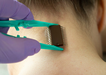 implantation of chip under the human skin. microchip is connected to the female body.
